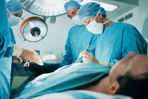 operacija dėl prostatito